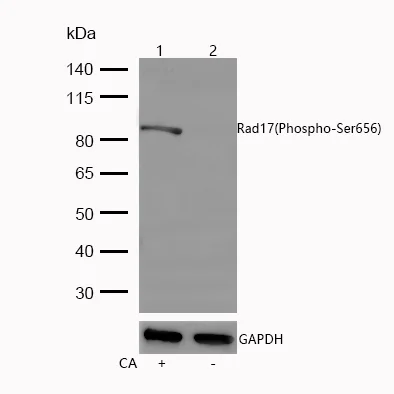 Western blot - Anti-Rad17 (phospho S656) antibody [SR2259] (AB326664)