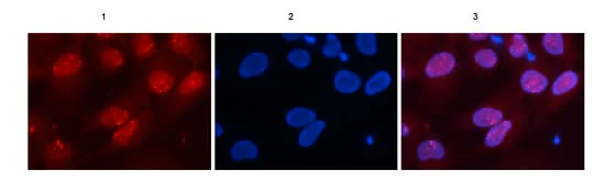 Immunocytochemistry/ Immunofluorescence - Anti-RAD18 antibody (AB188235)