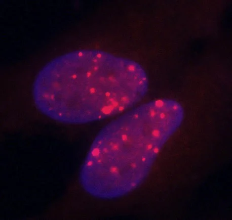 Immunocytochemistry/ Immunofluorescence - Anti-RAD18 antibody (AB188235)
