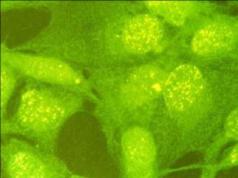 Immunocytochemistry/ Immunofluorescence - Anti-RAD18 antibody (AB79763)