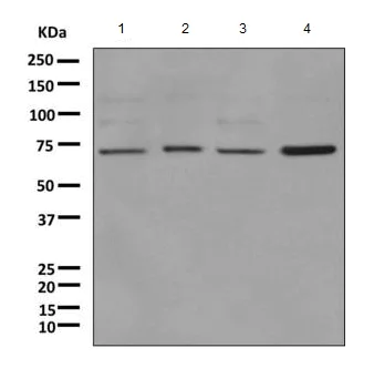 Western blot - Anti-RAD18 antibody [EPR8942] (AB157463)