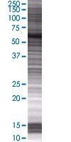 SDS-PAGE - RAD18 overexpression 293T lysate (whole cell) (AB94312), expandable thumbnail