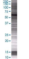 SDS-PAGE - RAD18 overexpression 293T lysate (whole cell) (AB94312)