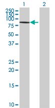 Western blot - RAD18 overexpression 293T lysate (whole cell) (AB94312), expandable thumbnail