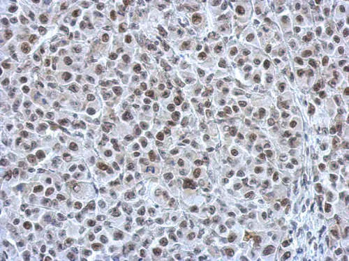 Immunohistochemistry (Formalin/PFA-fixed paraffin-embedded sections) - Anti-Rad21 antibody (AB154769)
