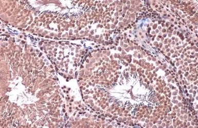 Anti-Rad21 antibody (ab154769) | Abcam