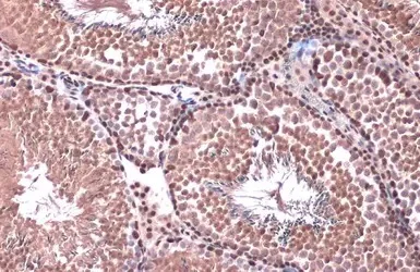 Immunohistochemistry (Formalin/PFA-fixed paraffin-embedded sections) - Anti-Rad21 antibody (AB154769)