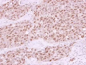 Immunohistochemistry (Formalin/PFA-fixed paraffin-embedded sections) - Anti-Rad21 antibody (AB154769)