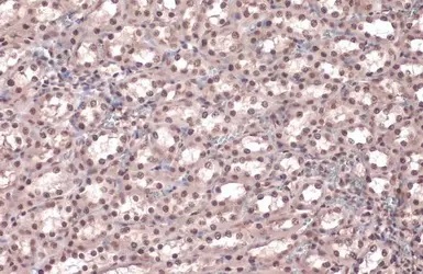 Anti-Rad21 antibody (ab154769) | Abcam