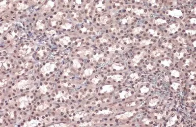 Immunohistochemistry (Formalin/PFA-fixed paraffin-embedded sections) - Anti-Rad21 antibody (AB154769)