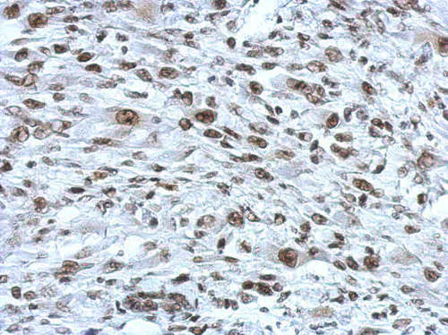 Immunohistochemistry (Formalin/PFA-fixed paraffin-embedded sections) - Anti-Rad21 antibody (AB154769)