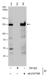 Immunoprecipitation - Anti-Rad21 antibody (AB154769)