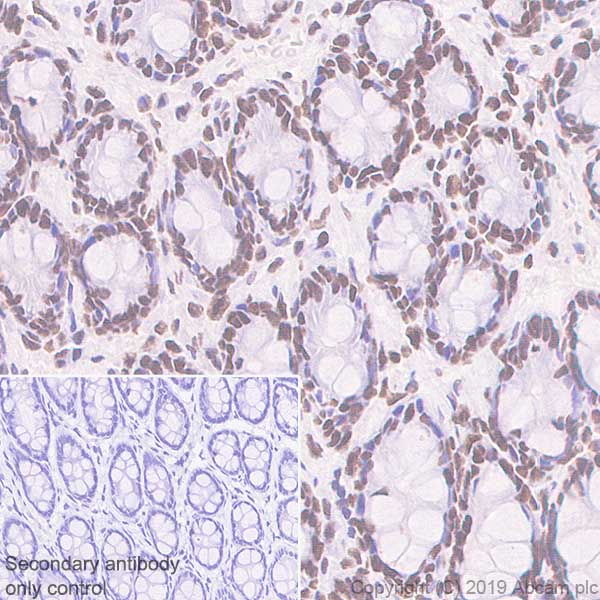 Immunohistochemistry (Formalin/PFA-fixed paraffin-embedded sections) - Anti-Rad21 antibody [EPR22506-15] - ChIP Grade (ab217678), expandable thumbnail