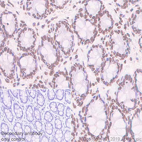 Immunohistochemistry (Formalin/PFA-fixed paraffin-embedded sections) - Anti-Rad21 antibody [EPR22506-15] - ChIP Grade (AB217678)