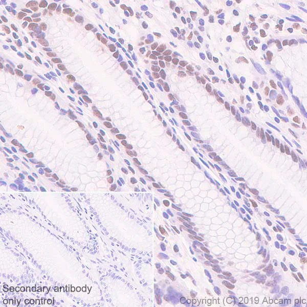 Immunohistochemistry (Formalin/PFA-fixed paraffin-embedded sections) - Anti-Rad21 antibody [EPR22506-15] - ChIP Grade (AB217678)