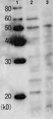 Western blot - Anti-Rad22 antibody (AB63800)