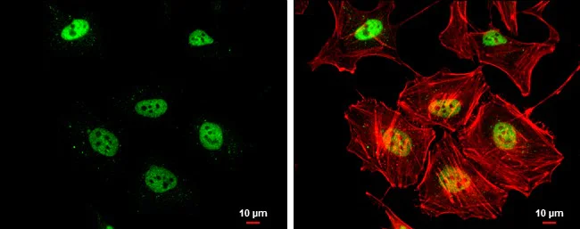 Immunocytochemistry/ Immunofluorescence - Anti-Rad50 antibody [13B3/2C6] (AB89)