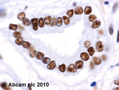 Immunohistochemistry (Formalin/PFA-fixed paraffin-embedded sections) - Anti-Rad50 antibody [13B3/2C6] (AB89)