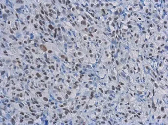 Immunohistochemistry (Formalin/PFA-fixed paraffin-embedded sections) - Anti-Rad50 antibody [13B3/2C6] (AB89)