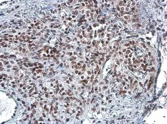 Immunohistochemistry (Formalin/PFA-fixed paraffin-embedded sections) - Anti-Rad50 antibody [13B3/2C6] (AB89)