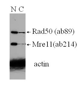 Western blot - Anti-Rad50 antibody [13B3/2C6] (AB89)