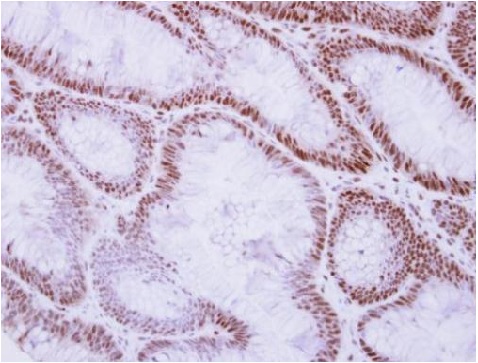 Immunohistochemistry (Formalin/PFA-fixed paraffin-embedded sections) - Anti-Rad50 antibody (AB228886), expandable thumbnail