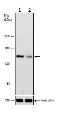 Western blot - Anti-Rad50 antibody (ab228886), expandable thumbnail