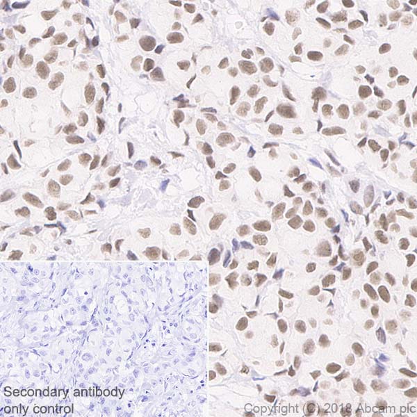 Immunohistochemistry (Formalin/PFA-fixed paraffin-embedded sections) - Anti-Rad50 antibody [EPR20968] - BSA and Azide free (AB236460), expandable thumbnail