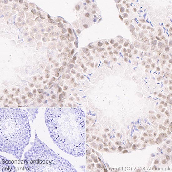 Immunohistochemistry (Formalin/PFA-fixed paraffin-embedded sections) - Anti-Rad50 antibody [EPR20968] - BSA and Azide free (AB236460), expandable thumbnail