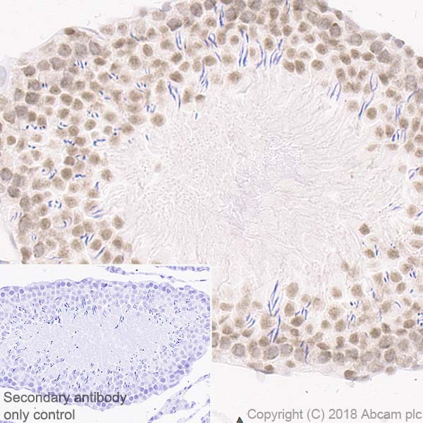 Immunohistochemistry (Formalin/PFA-fixed paraffin-embedded sections) - Anti-Rad50 antibody [EPR20968] - ChIP Grade (AB208019), expandable thumbnail