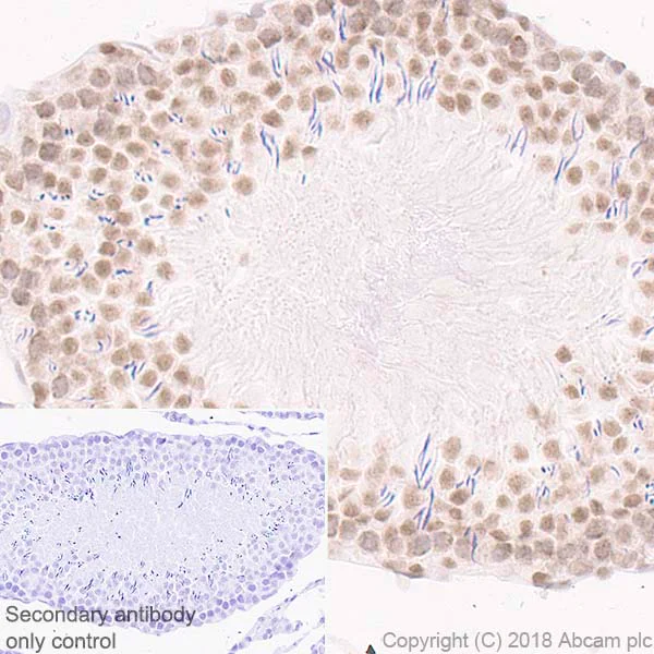 Immunohistochemistry (Formalin/PFA-fixed paraffin-embedded sections) - Anti-Rad50 antibody [EPR20968] - ChIP Grade (AB208019)