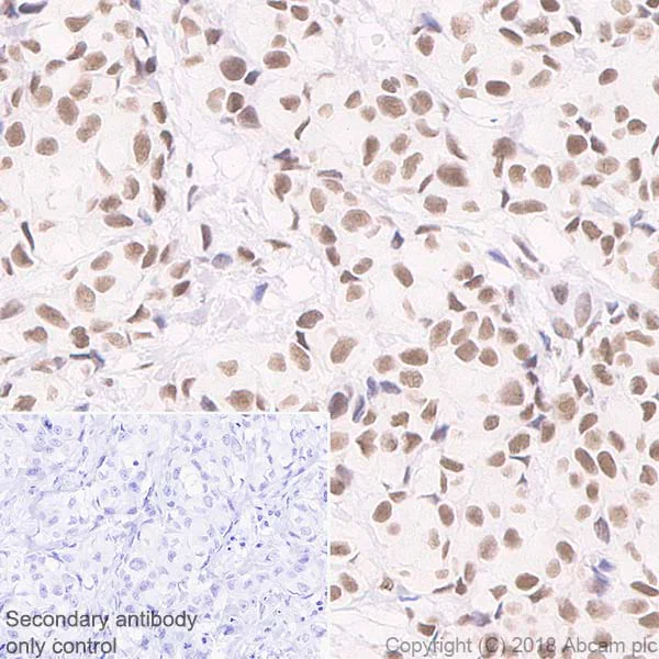 Immunohistochemistry (Formalin/PFA-fixed paraffin-embedded sections) - Anti-Rad50 antibody [EPR20968] - ChIP Grade (AB208019)