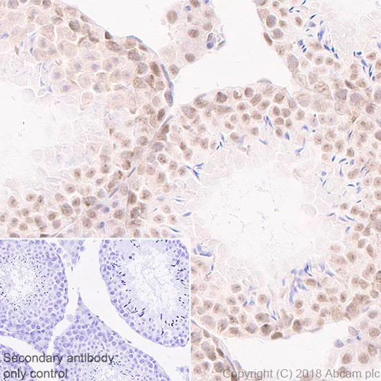 Immunohistochemistry (Formalin/PFA-fixed paraffin-embedded sections) - Anti-Rad50 antibody [EPR20968] - ChIP Grade (AB208019)