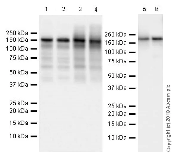 Western blot - Anti-Rad50 antibody [EPR20968] - ChIP Grade (AB208019)