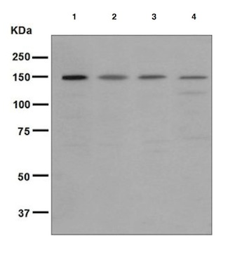 Western blot - Anti-Rad50 antibody [EPR3466(2)] (AB124682), expandable thumbnail