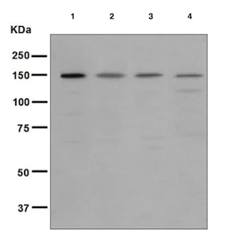 Western blot - Anti-Rad50 antibody [EPR3466(2)] (AB124682)