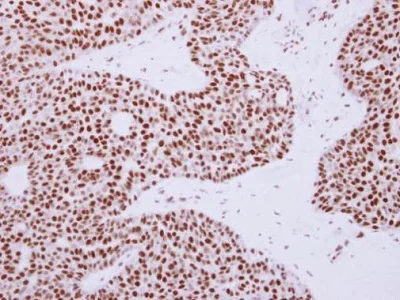 Immunohistochemistry (Formalin/PFA-fixed paraffin-embedded sections) - Anti-Rad50 antibody - N-terminal (AB228935)
