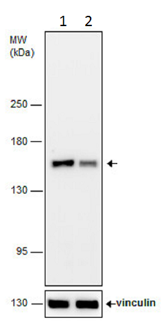 Western blot - Anti-Rad50 antibody - N-terminal (AB228935), expandable thumbnail