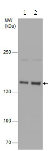 Western blot - Anti-Rad50 antibody - N-terminal (AB228935), expandable thumbnail