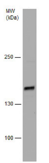 Western blot - Anti-Rad50 antibody - N-terminal (ab228935), expandable thumbnail