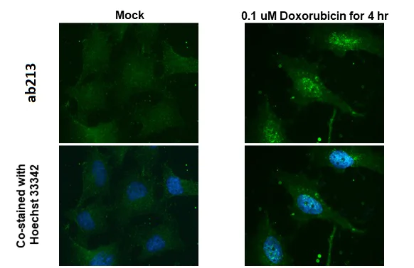 Immunocytochemistry/ Immunofluorescence - Anti-Rad51 antibody [14B4] (AB213)