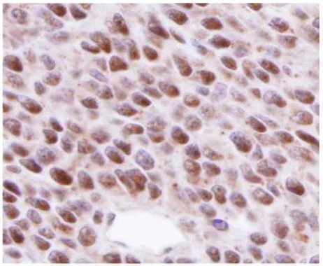 Immunohistochemistry (Formalin/PFA-fixed paraffin-embedded sections) - Anti-Rad51 antibody [14B4] (AB213)