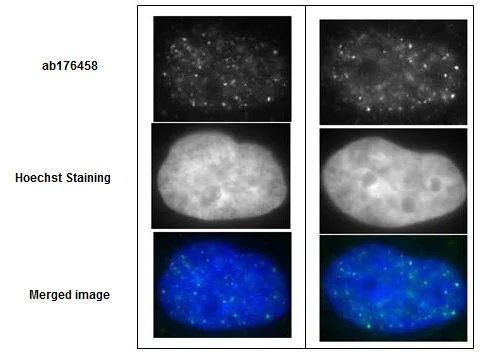 Immunocytochemistry/ Immunofluorescence - Anti-Rad51 antibody (AB176458)