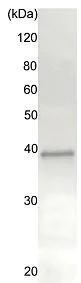 Immunoprecipitation - Anti-Rad51 antibody (AB176458)