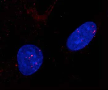 Immunocytochemistry/ Immunofluorescence - Anti-Rad51 antibody (AB63801)