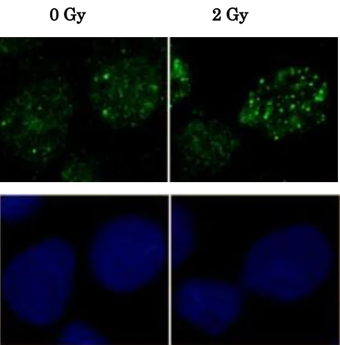 Immunocytochemistry/ Immunofluorescence - Anti-Rad51 antibody (AB63801)