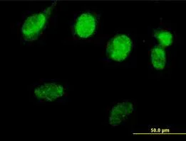 Immunocytochemistry/ Immunofluorescence - Anti-Rad51 antibody - BSA and Azide free (AB88572)