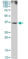 Western blot - Anti-Rad51 antibody - BSA and Azide free (AB88572)