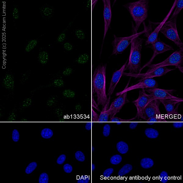 Immunocytochemistry/ Immunofluorescence - Anti-Rad51 antibody [EPR4030(3)] (ab133534), expandable thumbnail