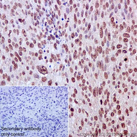 Immunohistochemistry (Formalin/PFA-fixed paraffin-embedded sections) - Anti-Rad51 antibody [EPR4030(3)] (AB133534), expandable thumbnail